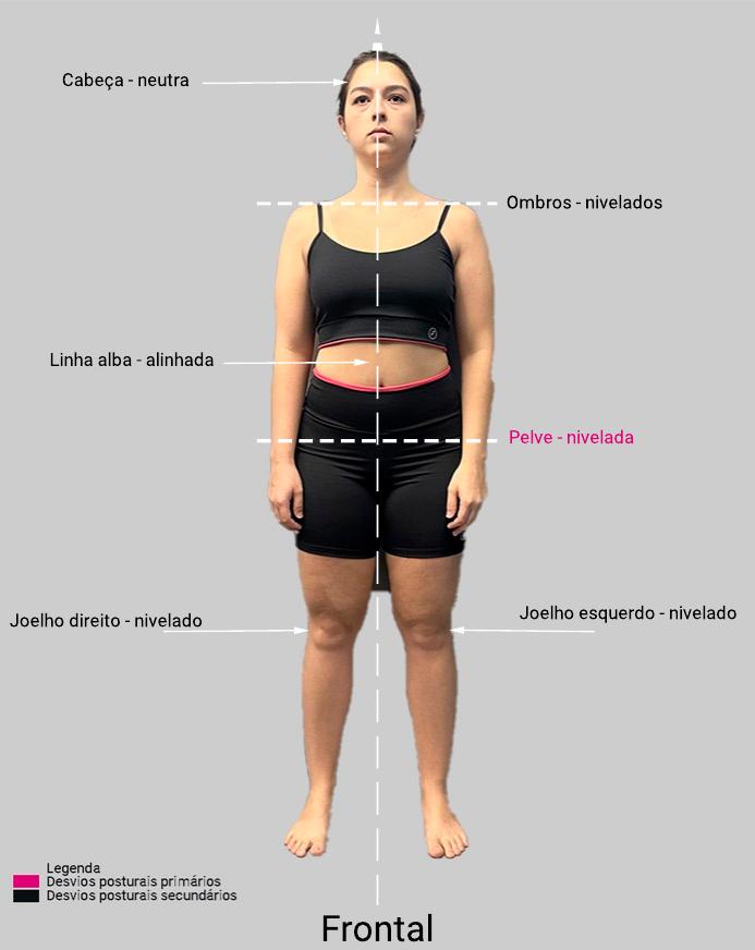 Análise postural 04