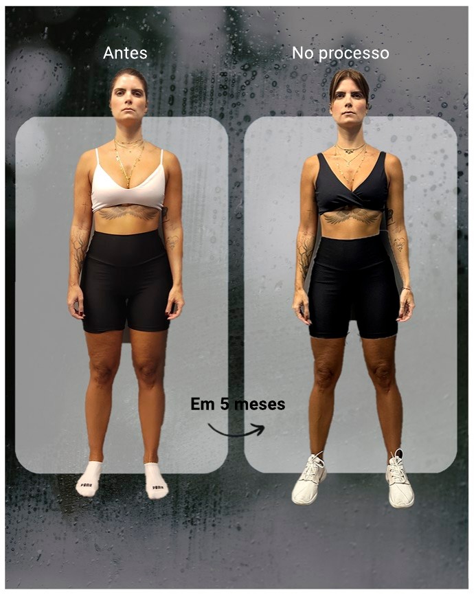 Análise postural 02
