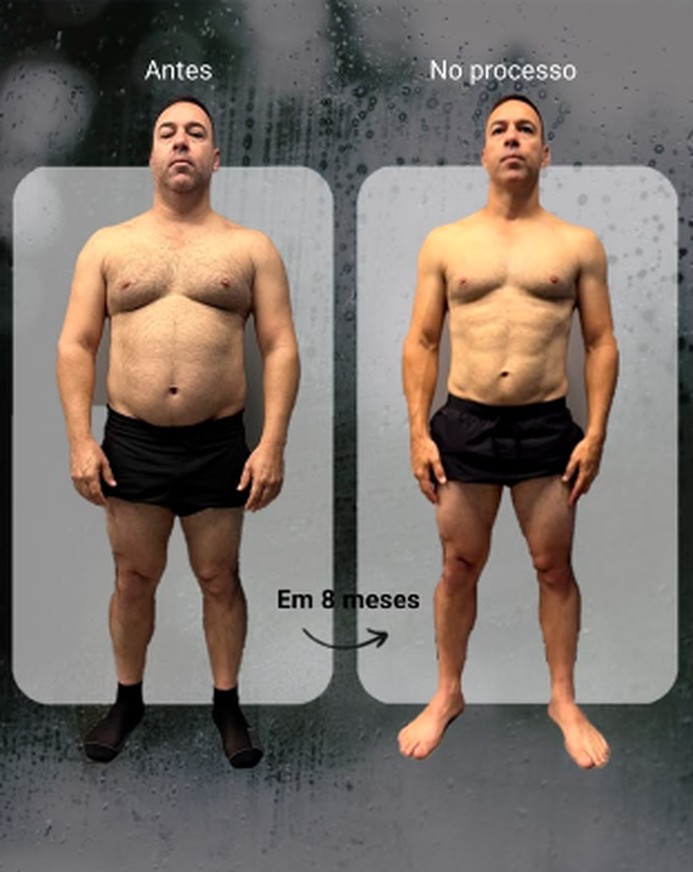 Análise postural 03