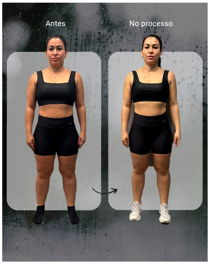 Análise postural 01