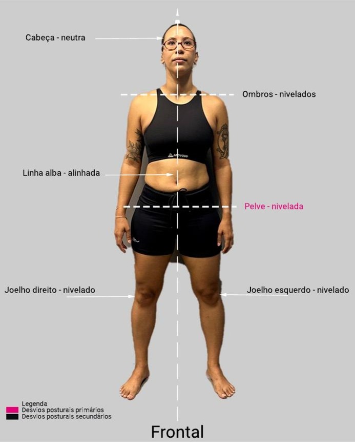 Análise postural 03