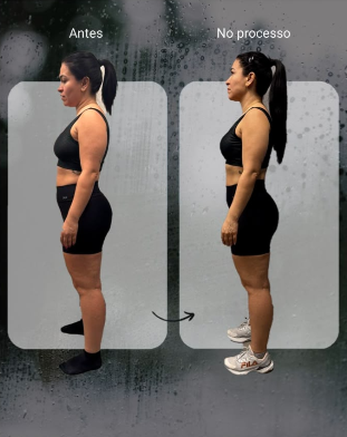 Análise postural 04