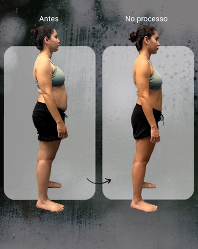Análise postural 01
